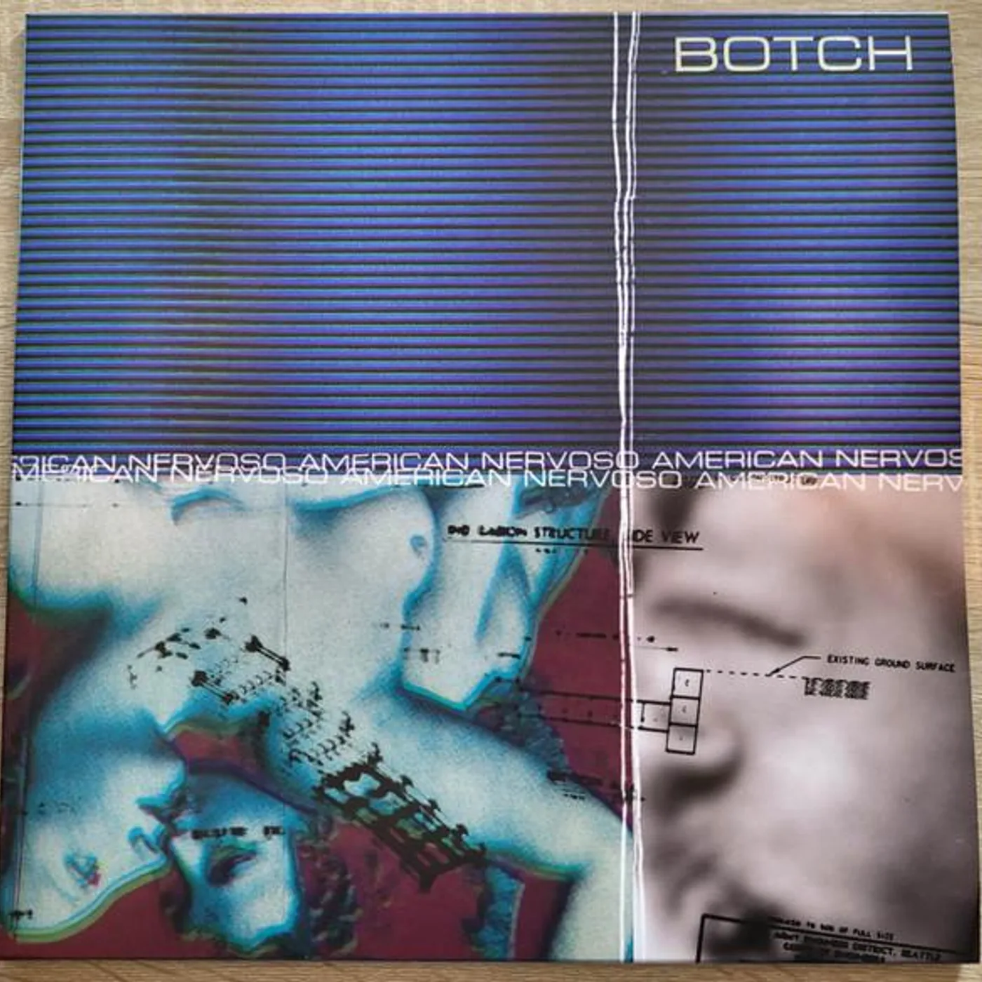 Botch AMERICAN NERVOSO (25TH ANNIVERSARY) (TRANSPARENT BLUE & SILVER VINYL) Vinyl Record