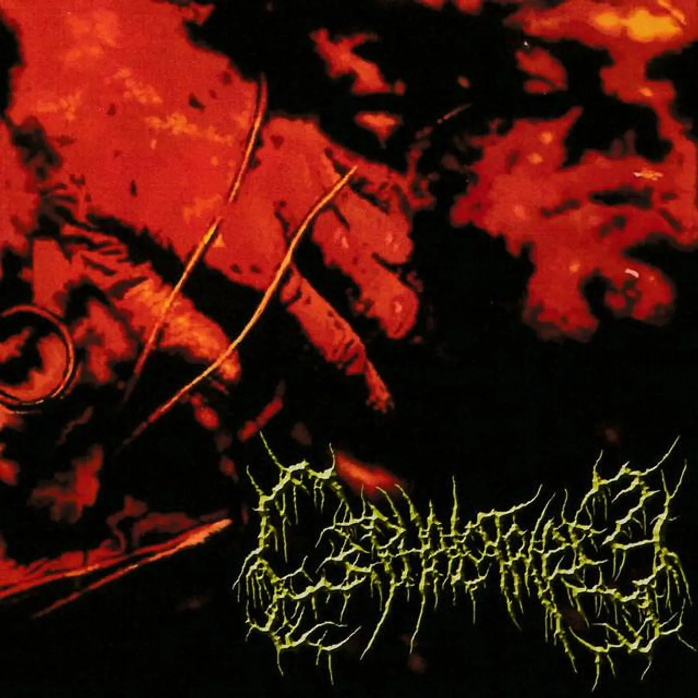 Cephalotripsy