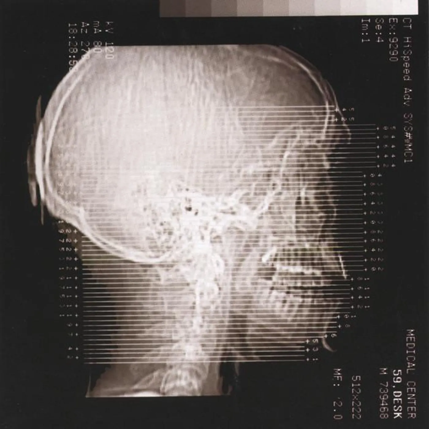 Cranium