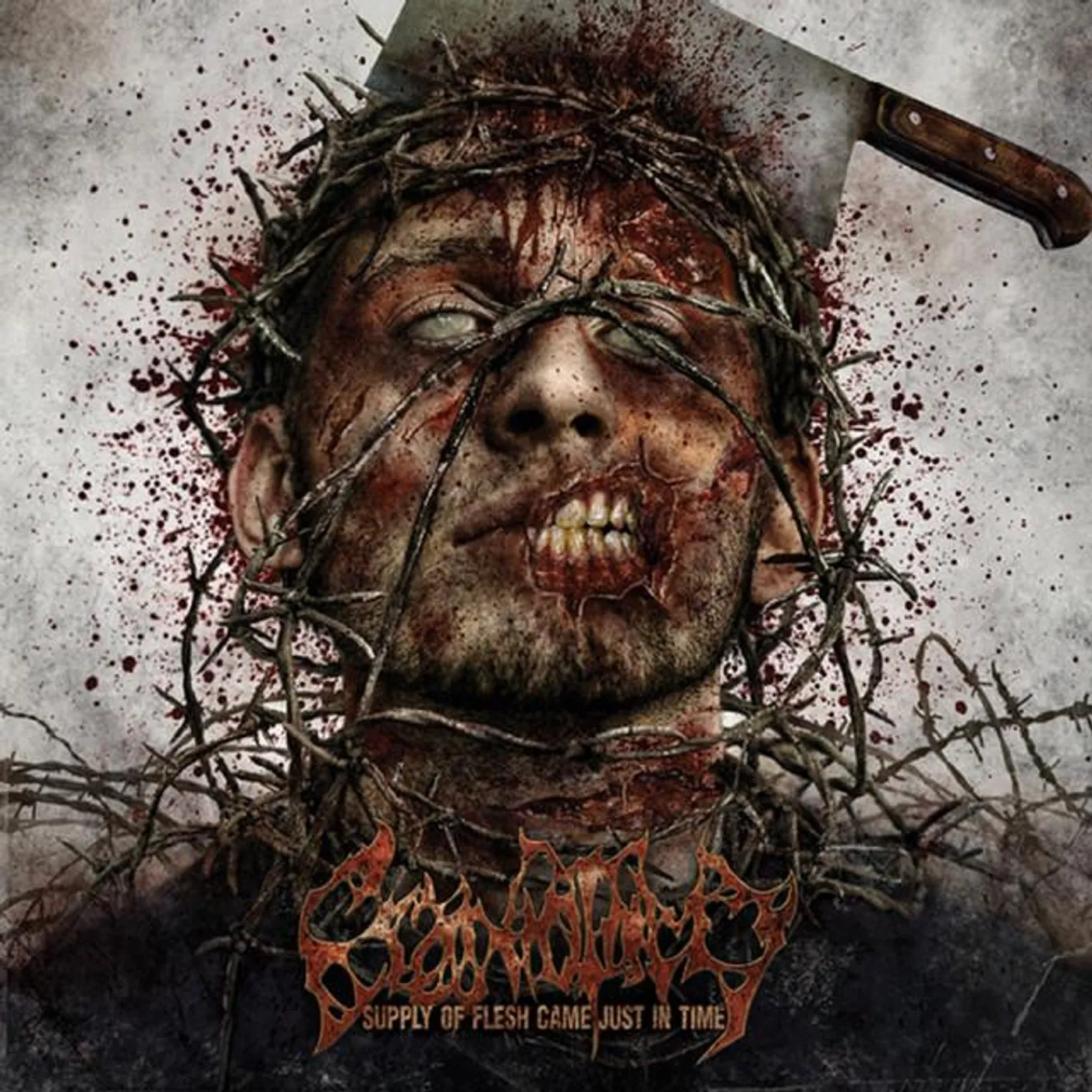 Craniotomy