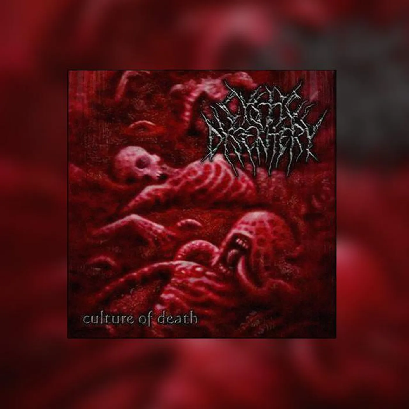 Cystic Dysentery