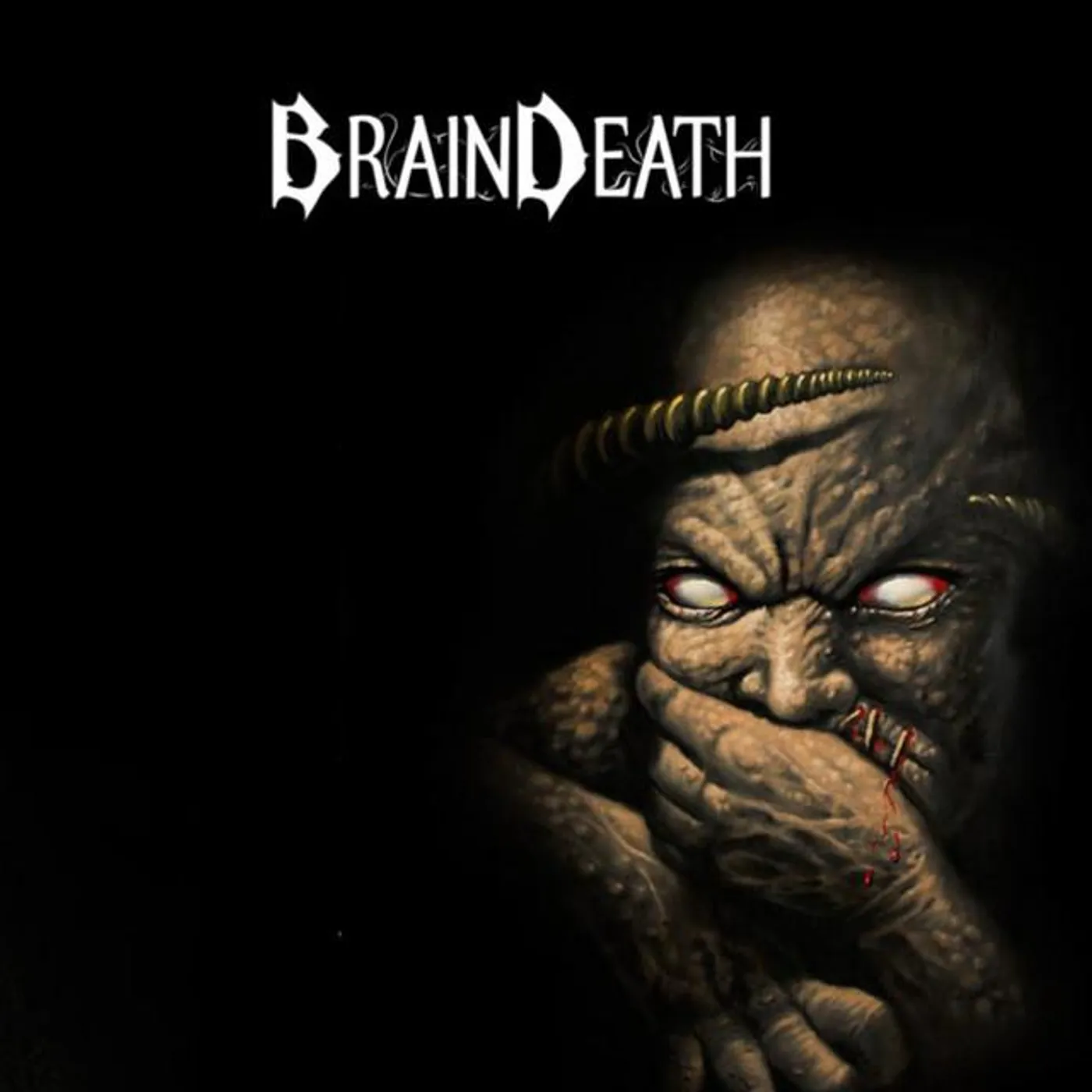 Brain Death