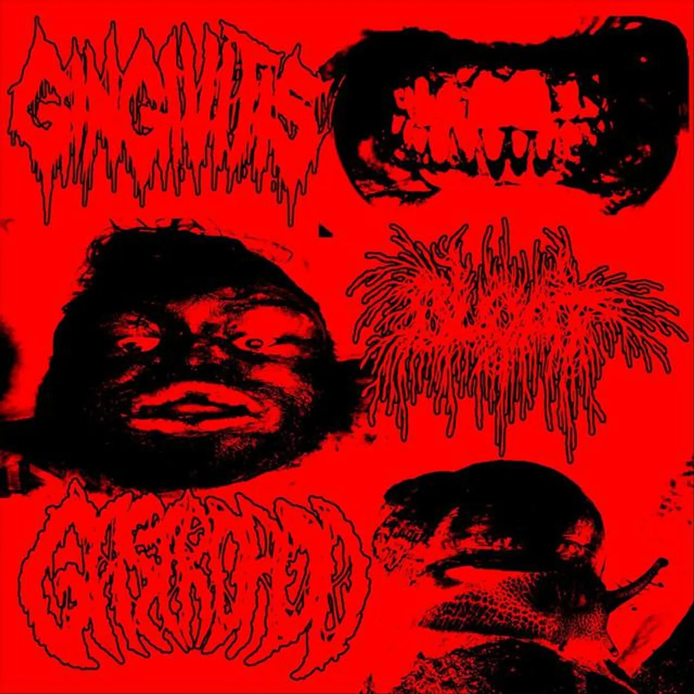 Gingivitis
