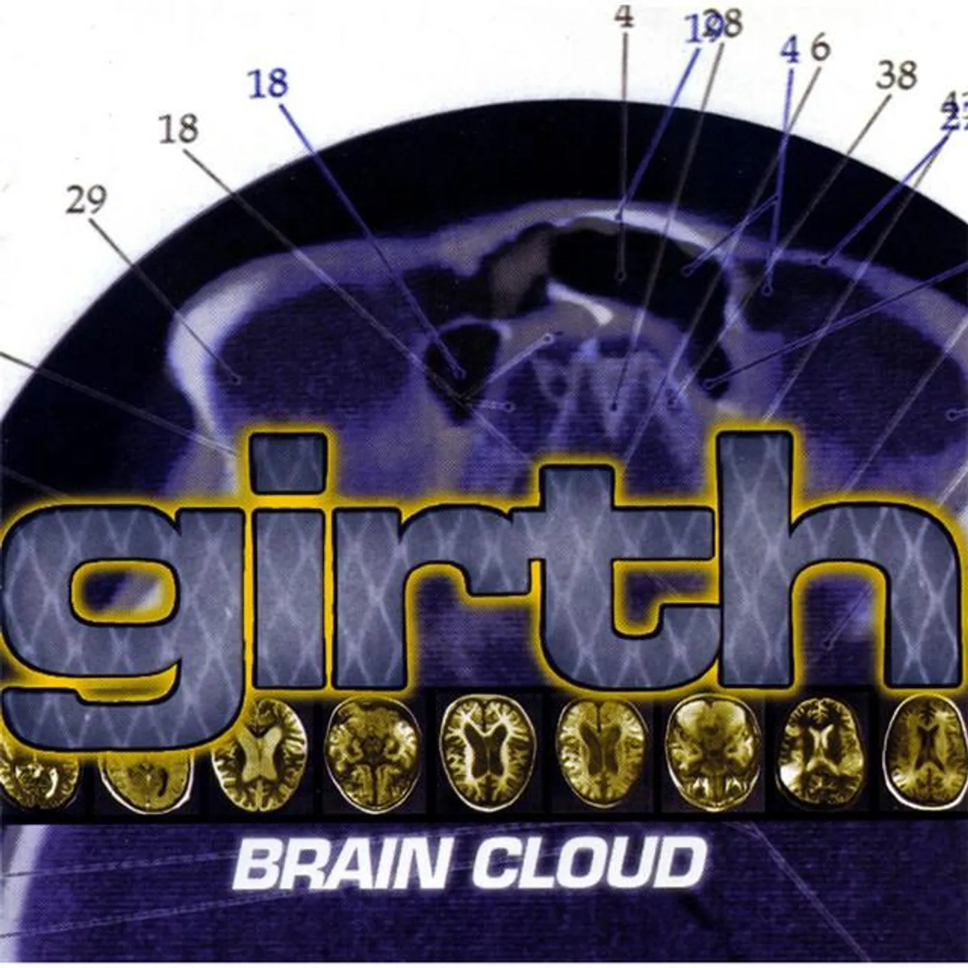Girth