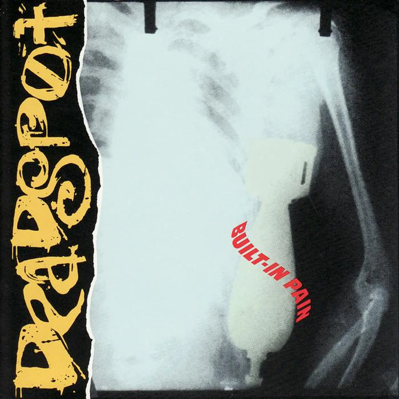 Deadspot