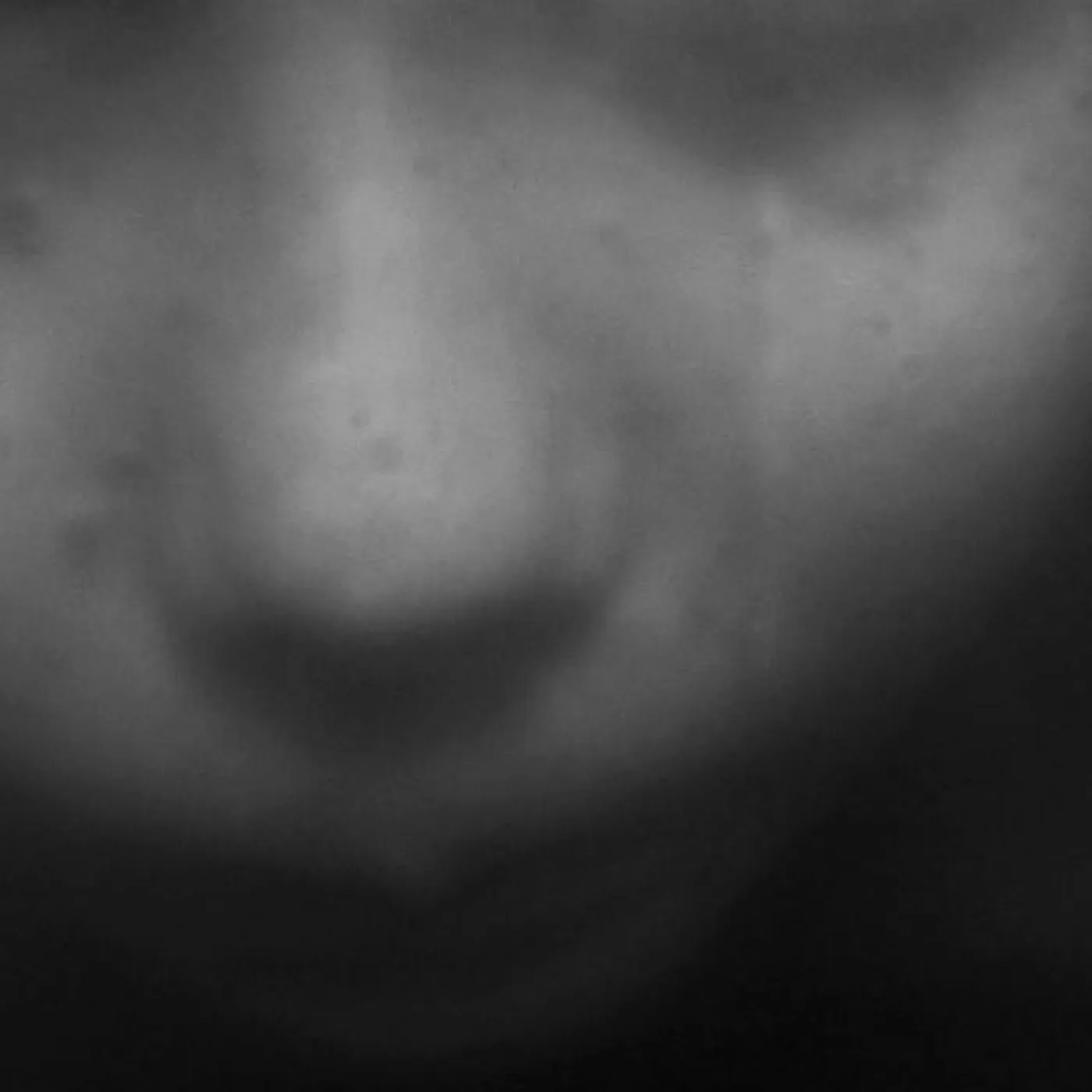 Eyes of Another