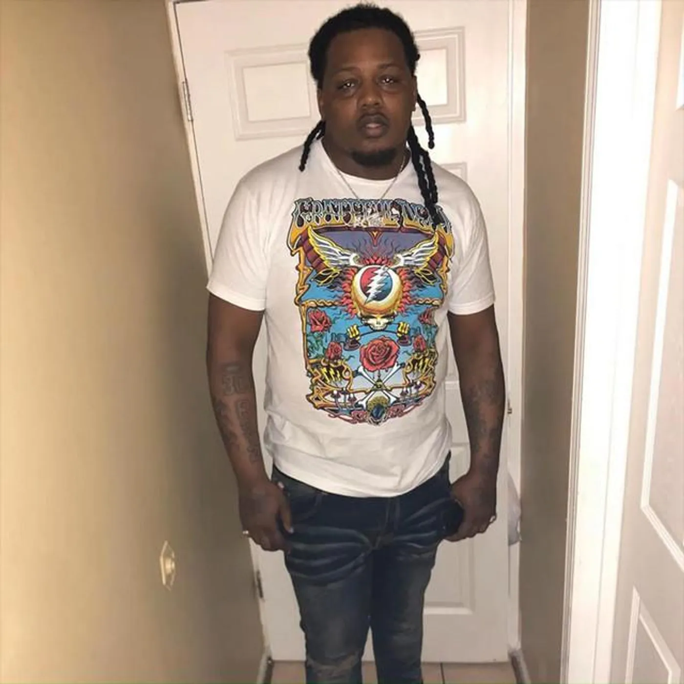 FBG