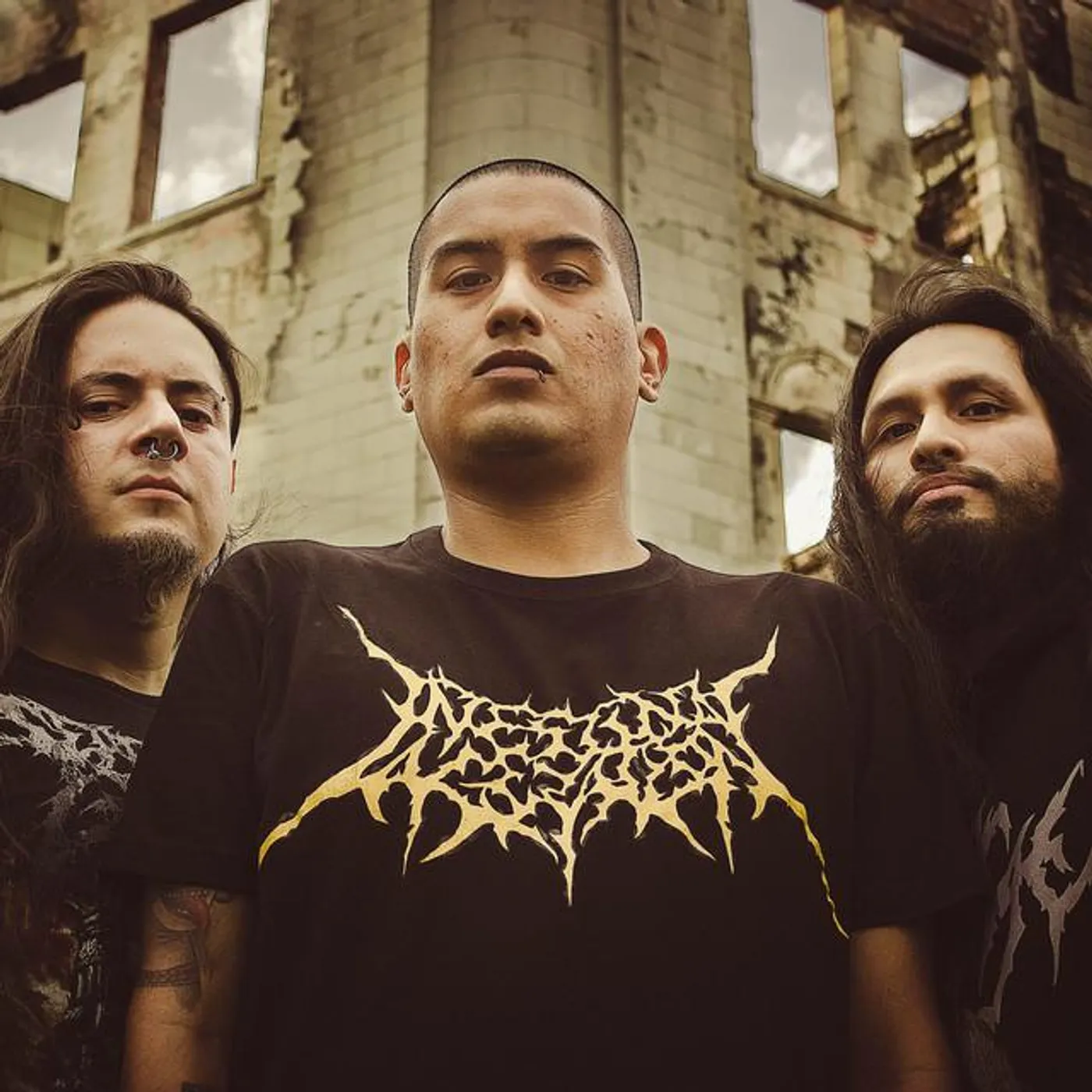 Intestinal Laceration