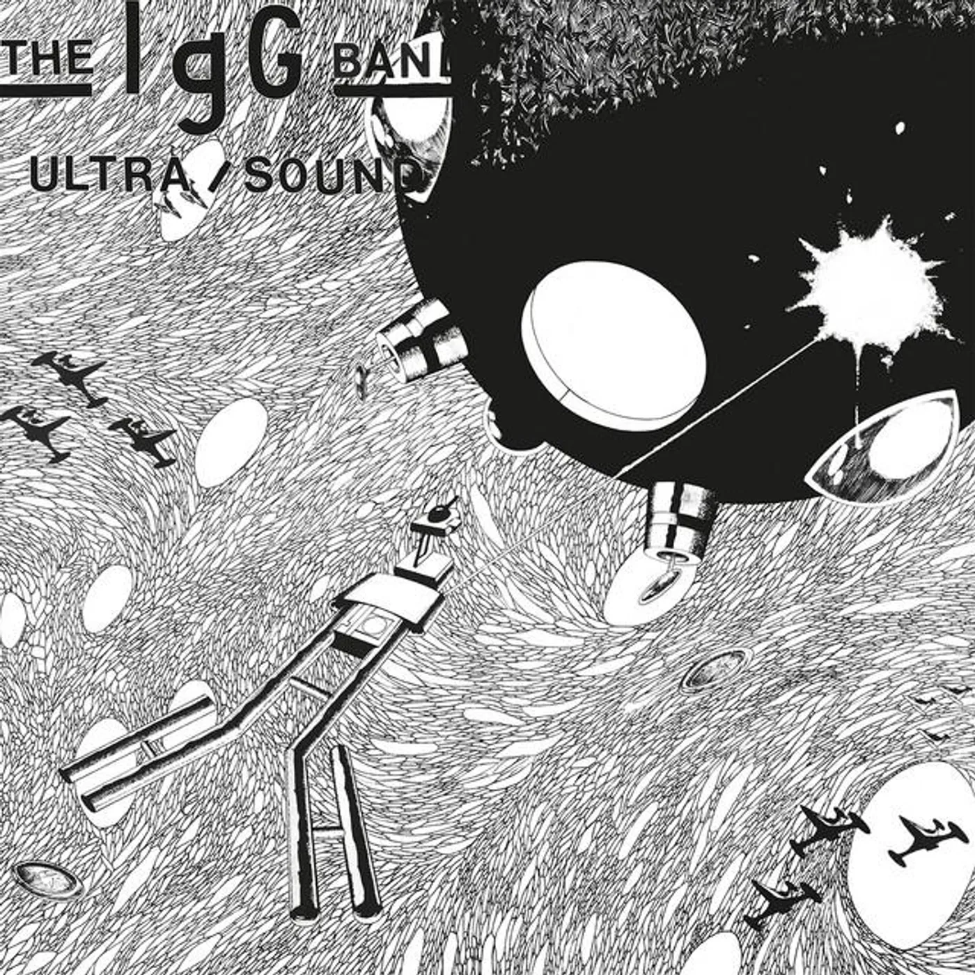 The IgG Band