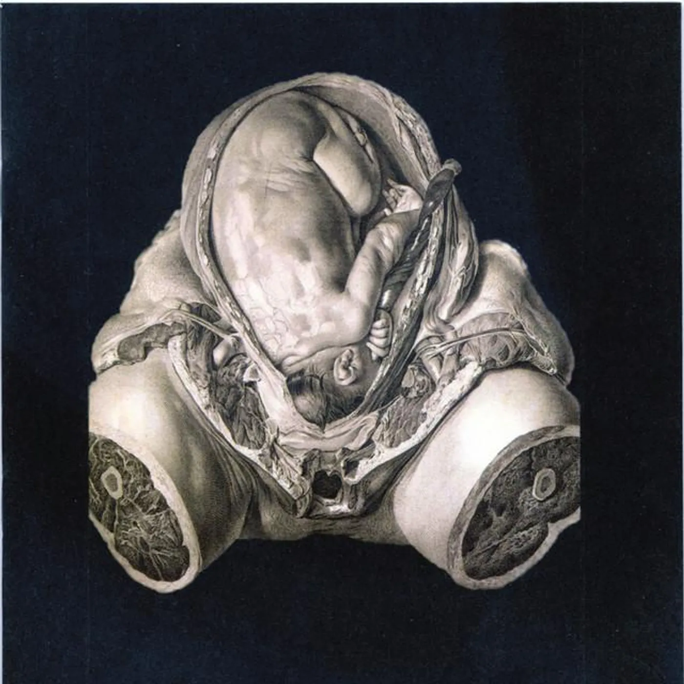 Orcustus