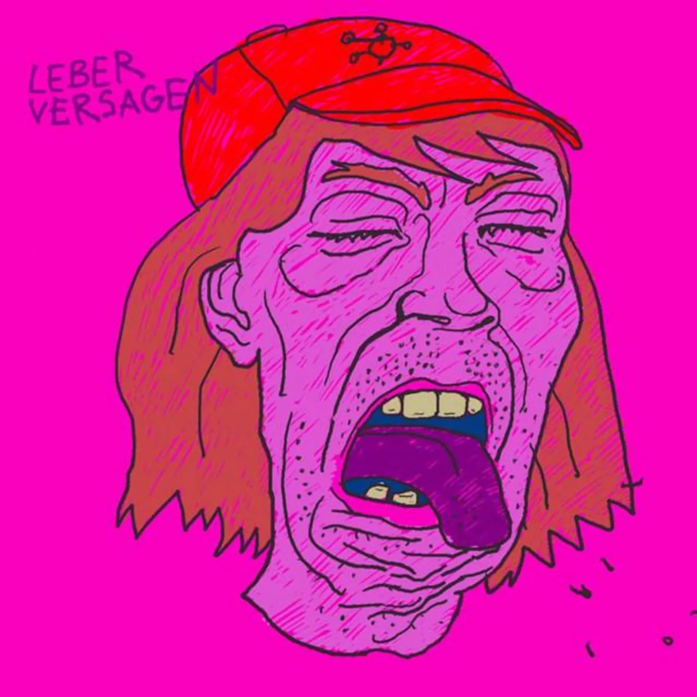 Leberversagen