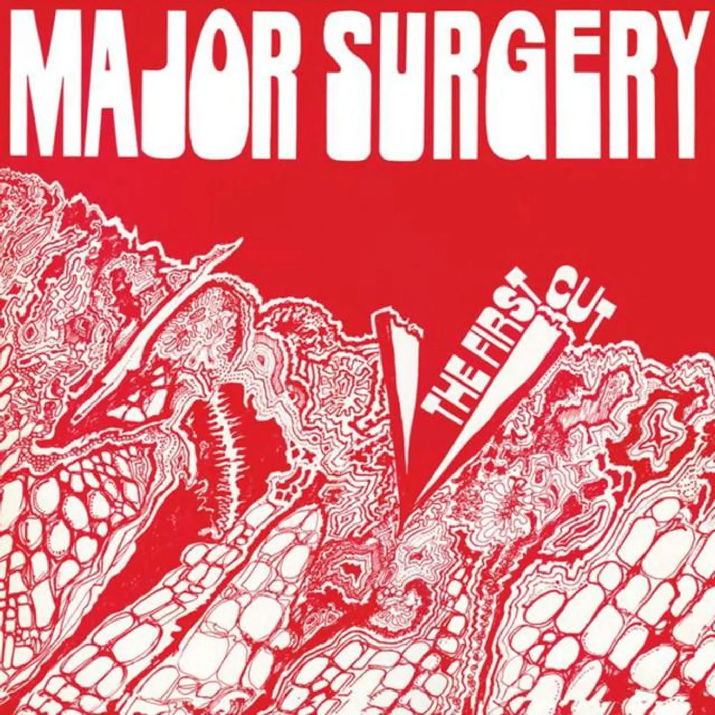 Major Surgery