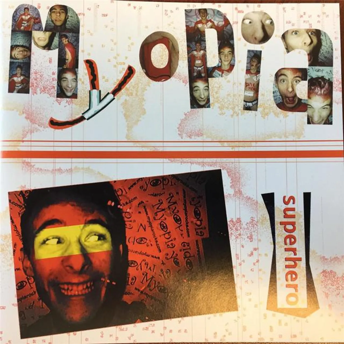 Myopia