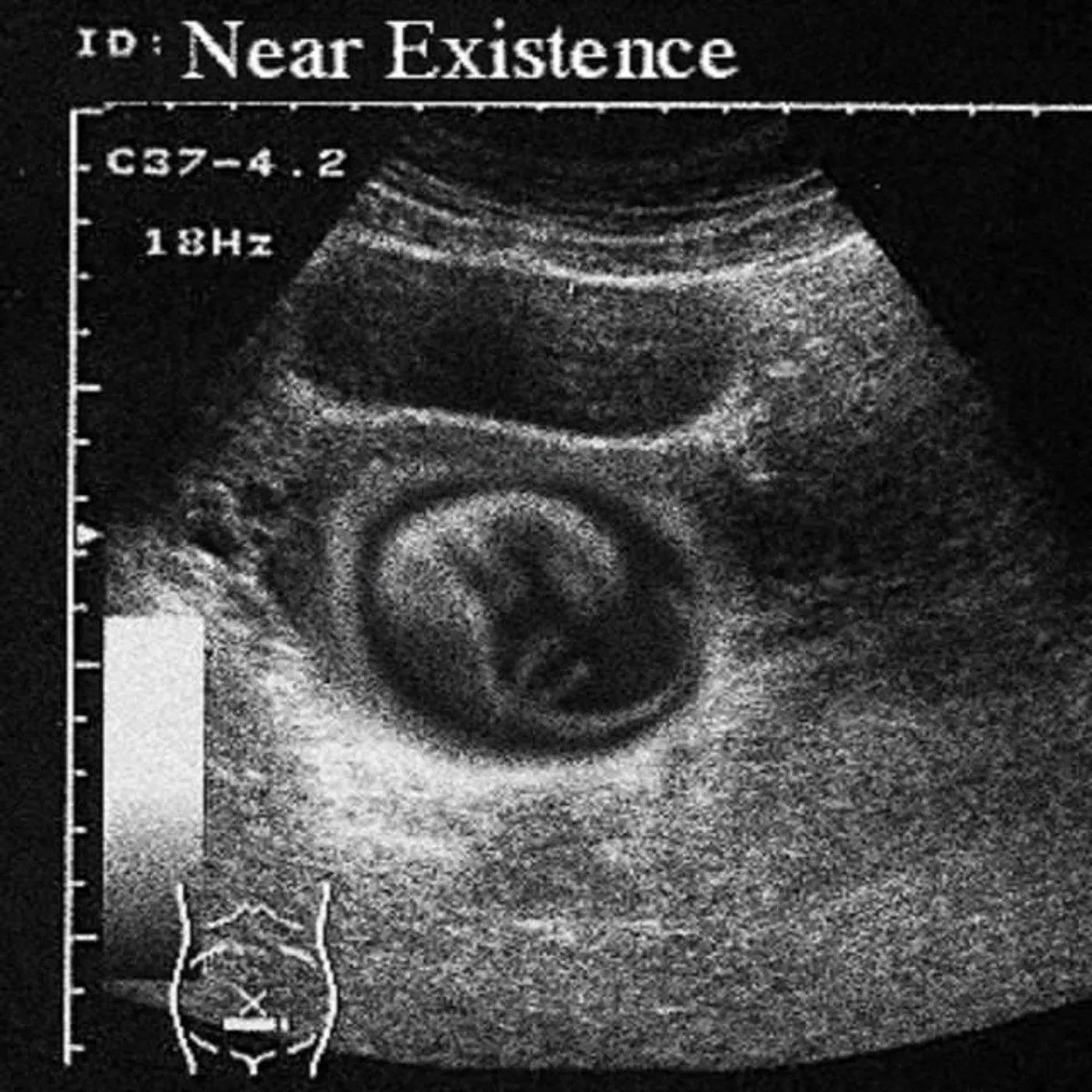 Near Existence