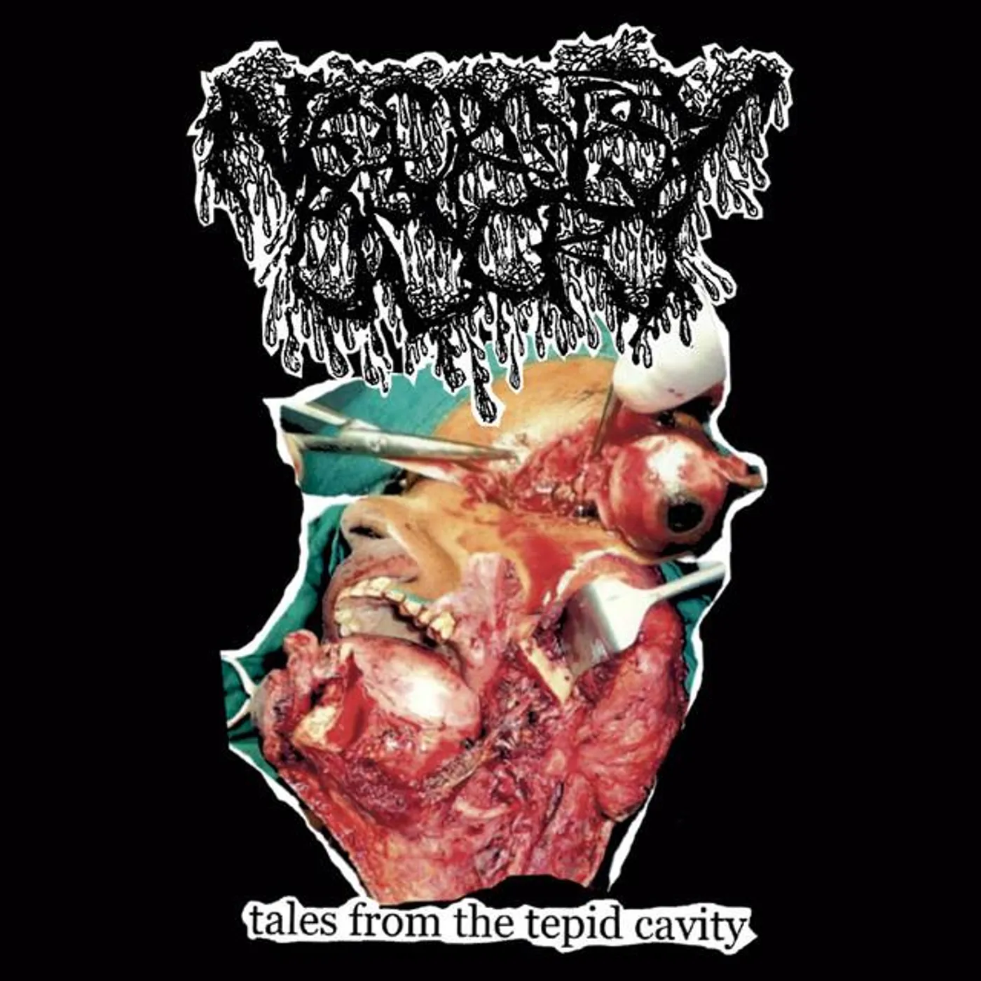 Necropsy Odor