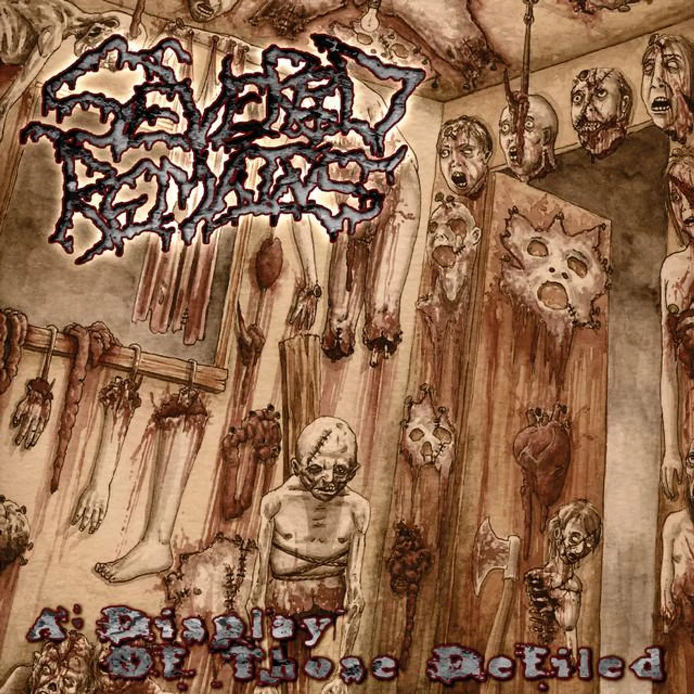Severed Remains