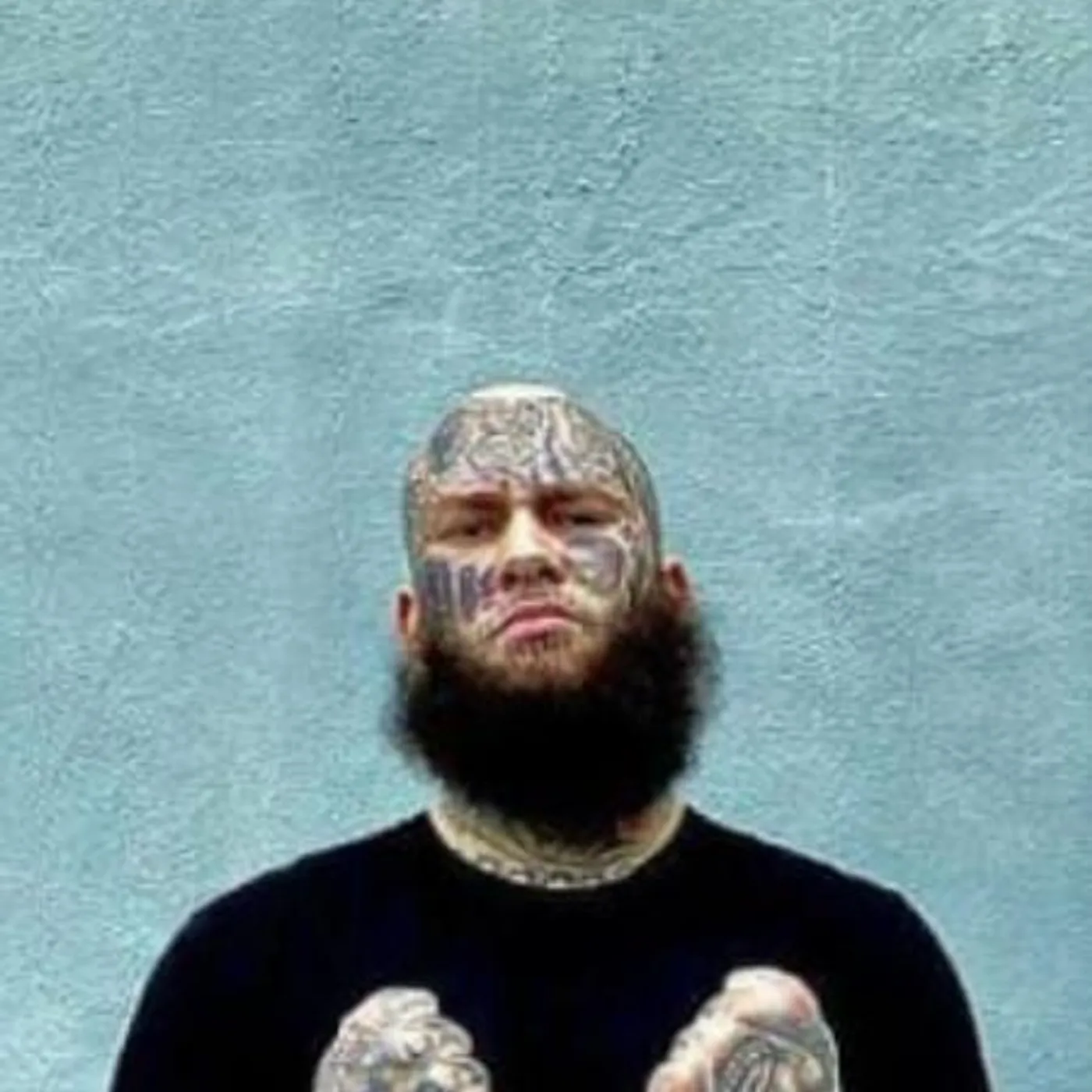 Stitches