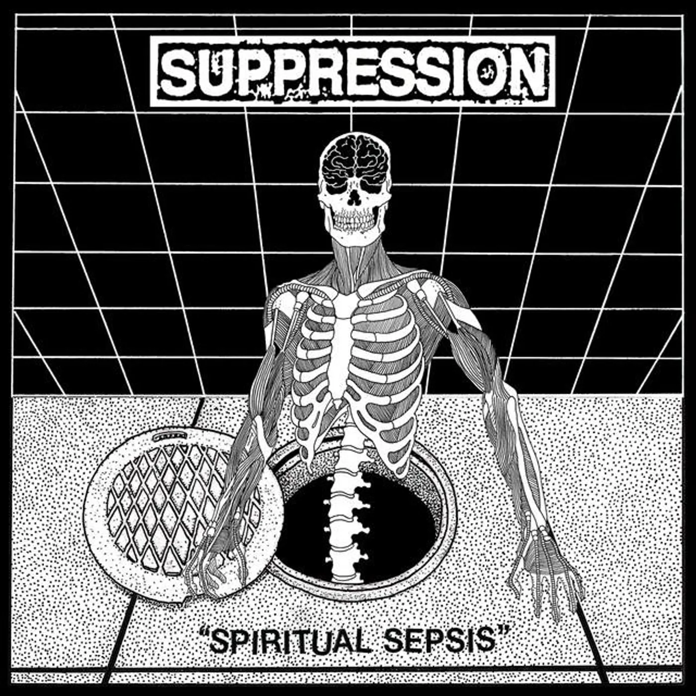 Suppression