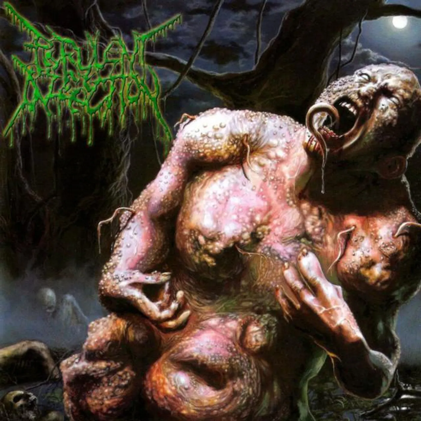 Purulent Infection