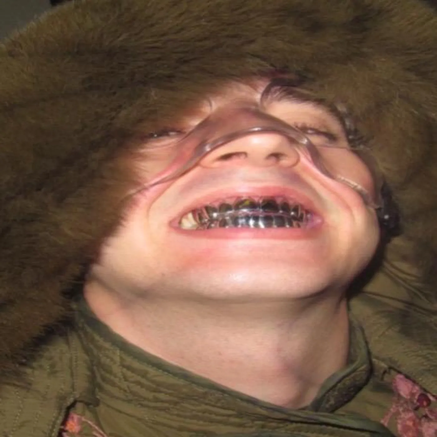 Ralphie Choo