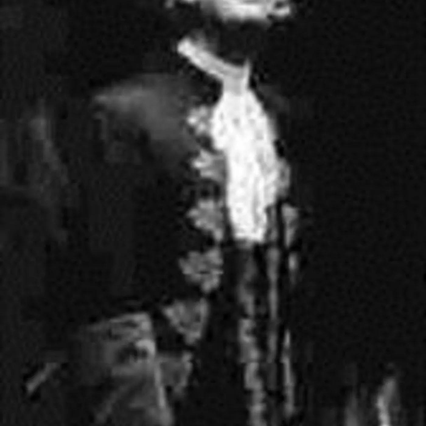 Renato Capecchi