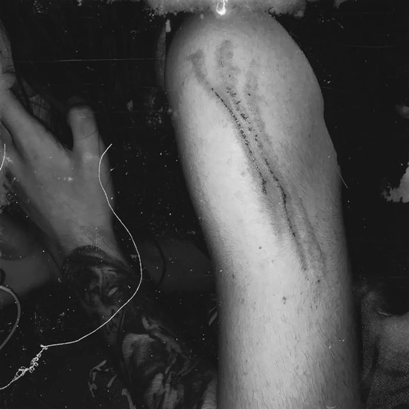 Undertaker