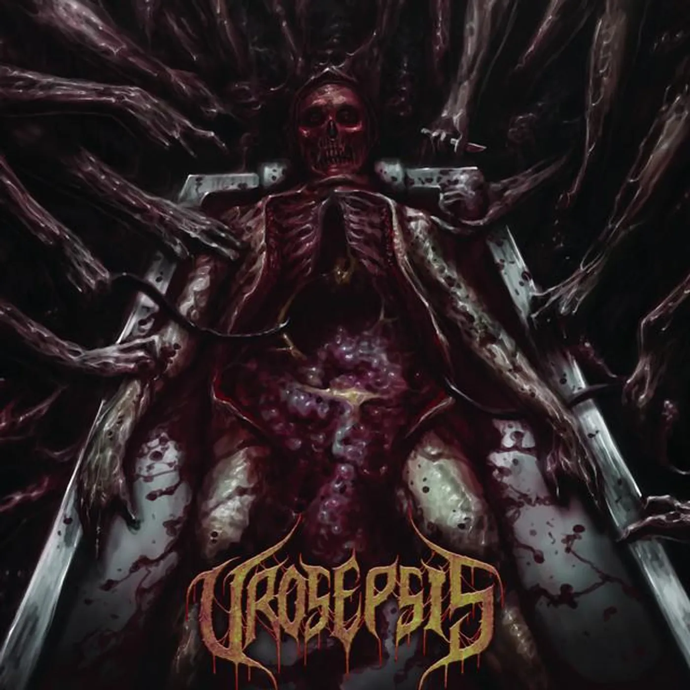 Urosepsis