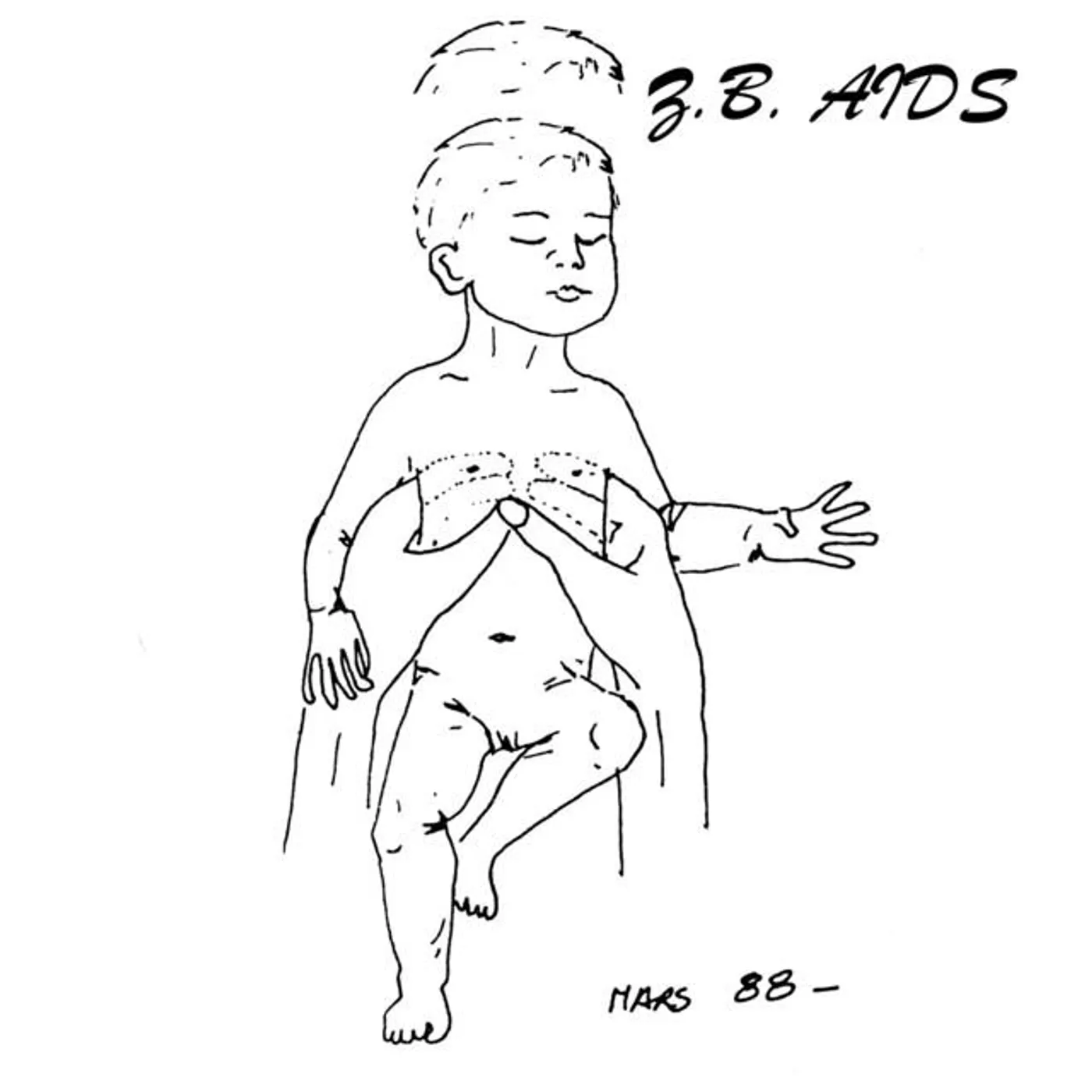 Z.B. Aids