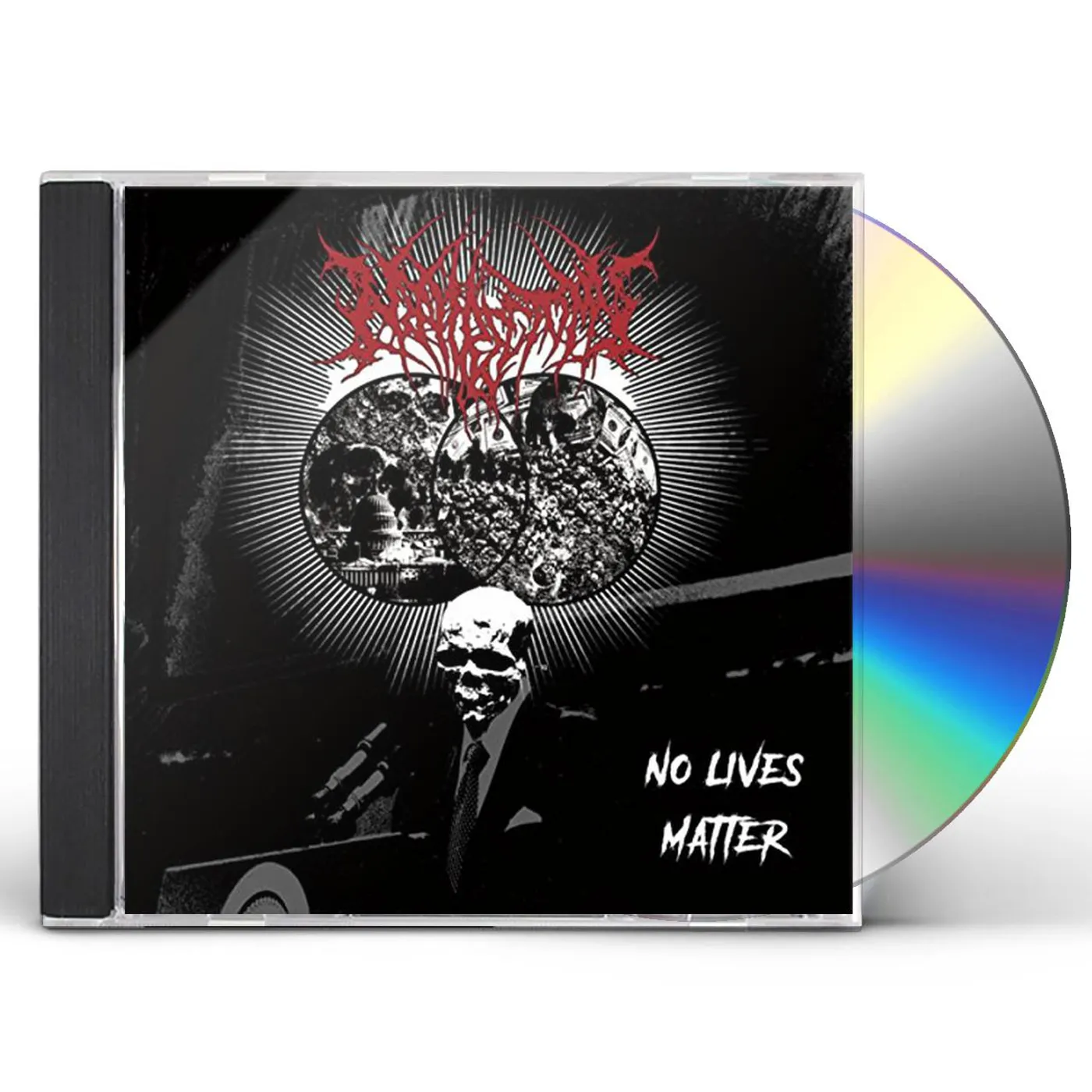 Nephrectomy NO LIVES MATTER CD