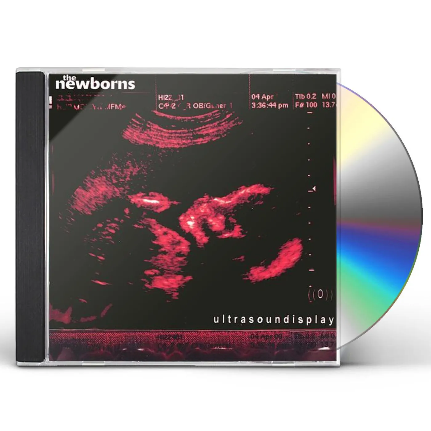Newborns ULTRASOUNDISPLAY CD