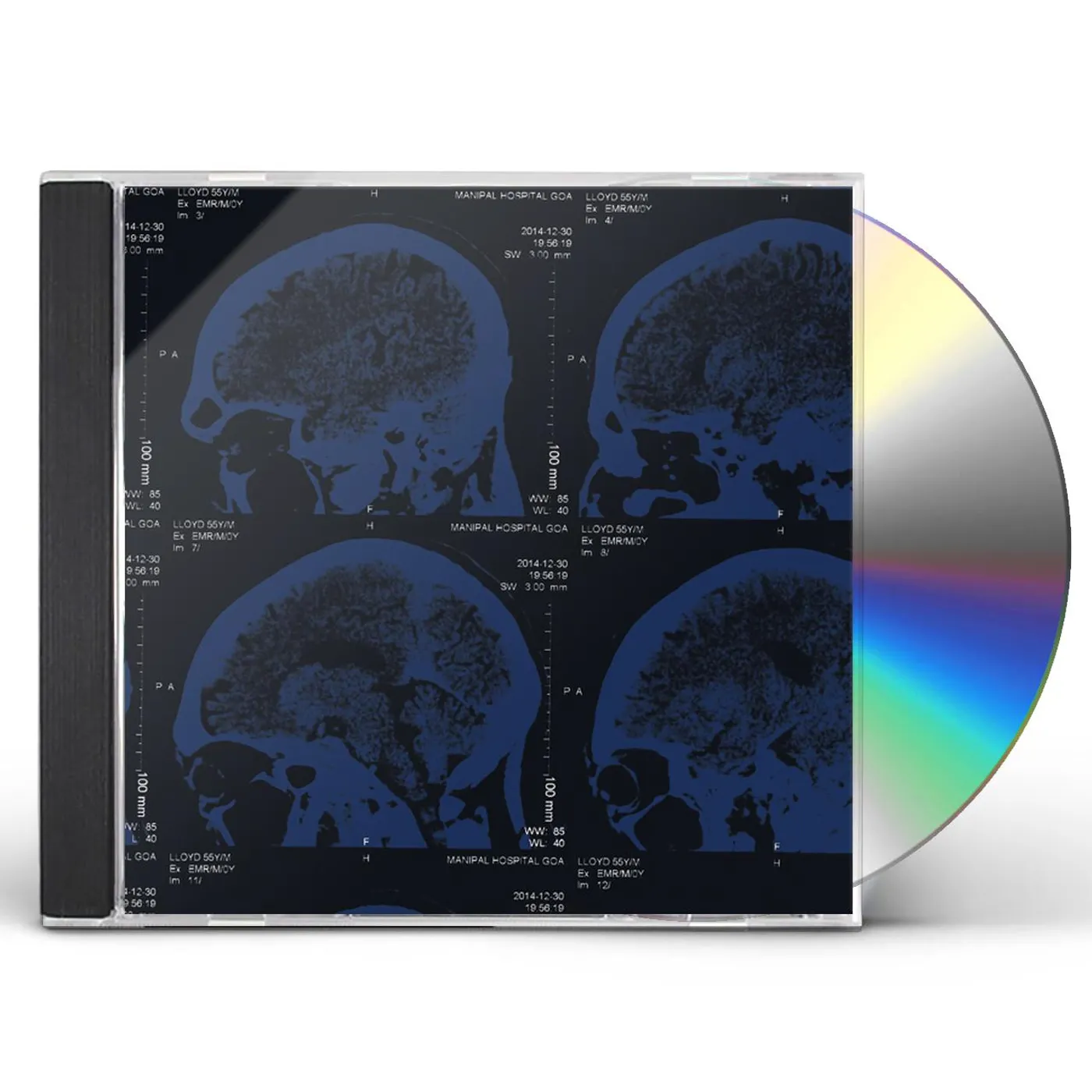 The Nightingales MIND OVER MATTER CD