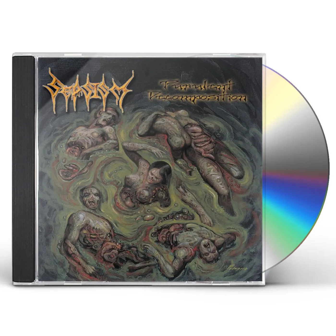 Sepsism PURULENT DECOMPOSITION CD