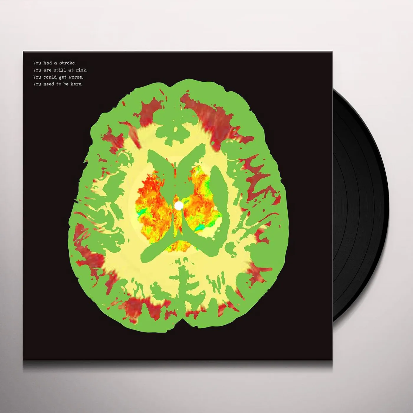 Minus 5 Stroke Manor Vinyl Record