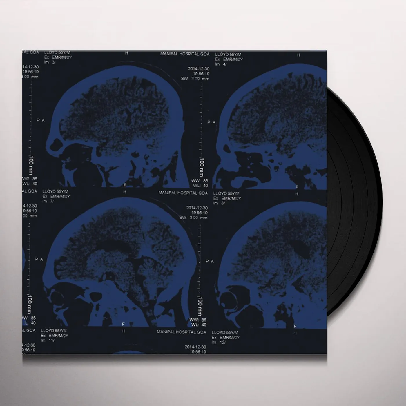 The Nightingales Mind over Matter Vinyl Record