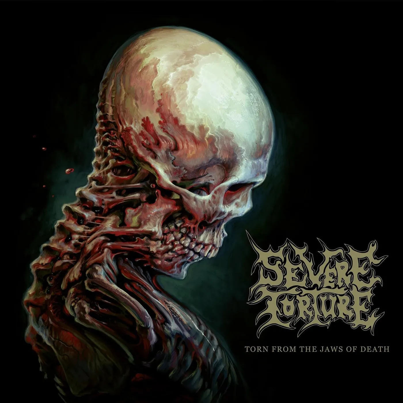 Severe Torture LP - Torn From The Jaws Of Death (Gold/Black Marbled Vinyl)