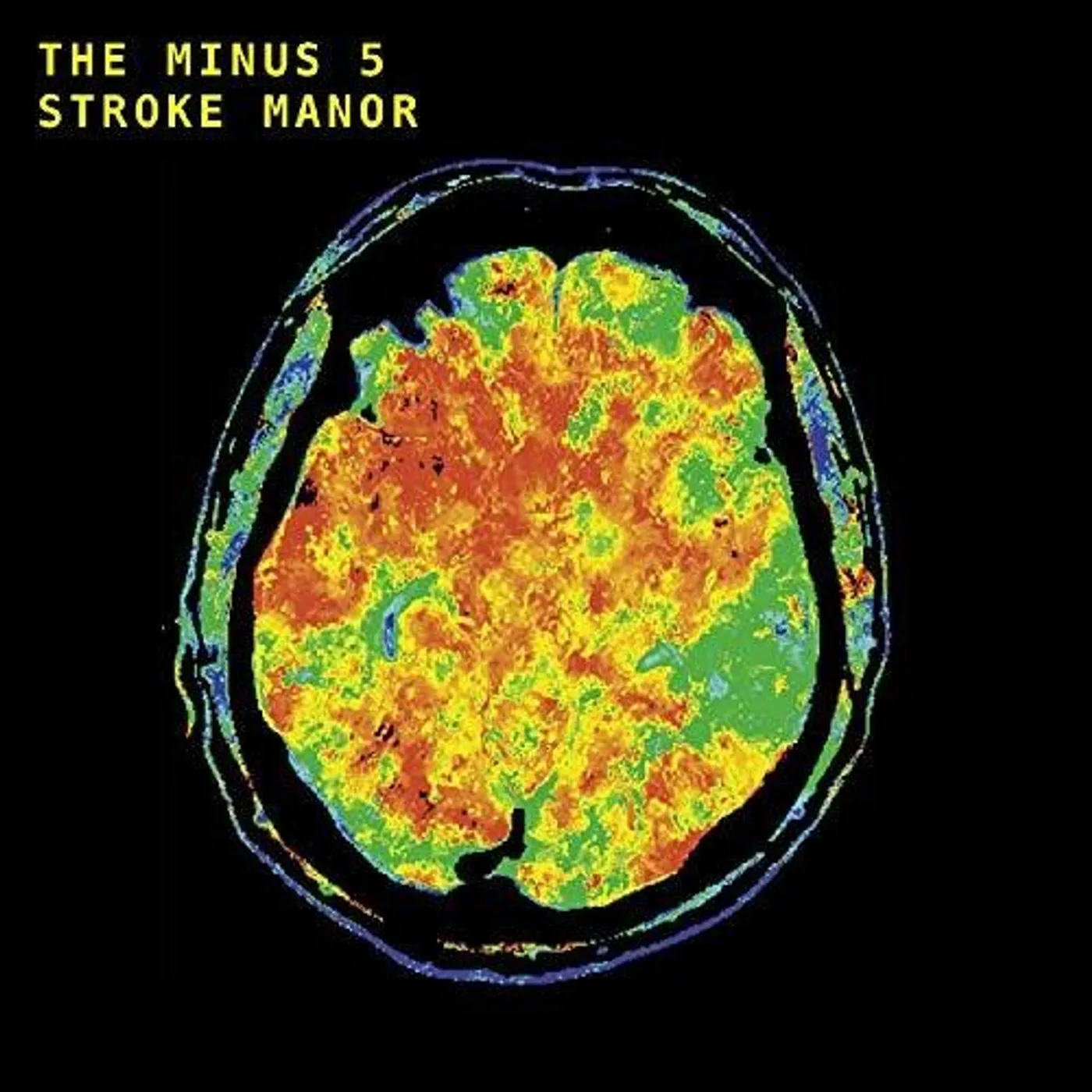 Minus 5 LP Vinyl - Stroke Manor (Dlcd)