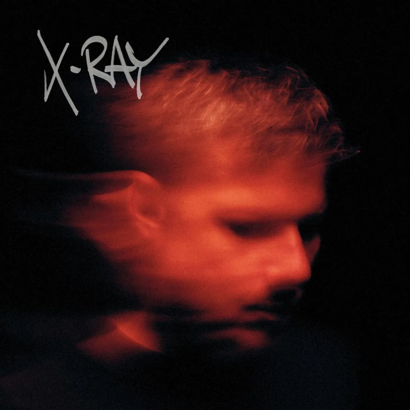 Murdock LP - X-Ray (Vinyl)