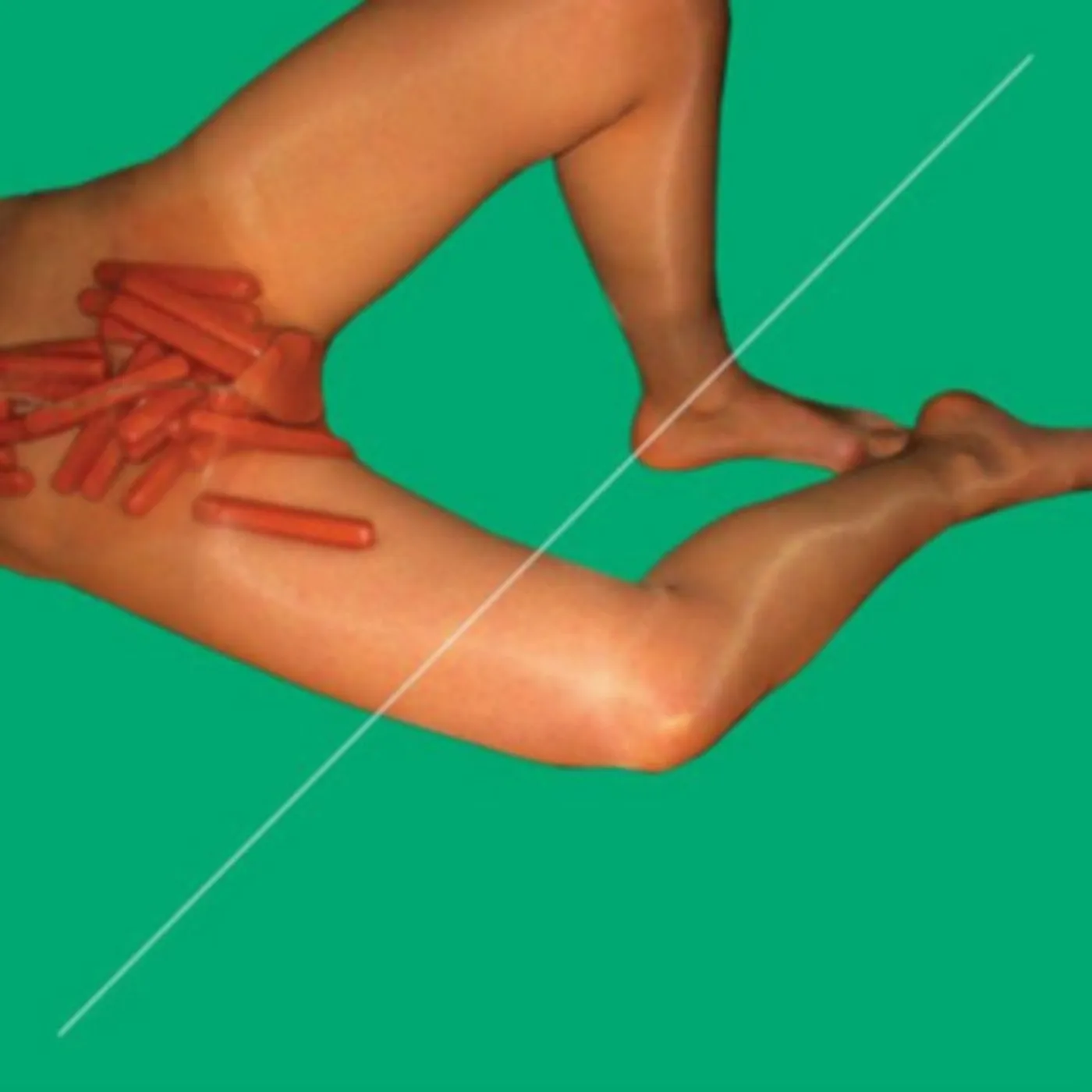 Peaches LP - Rub Remixed (Vinyl)