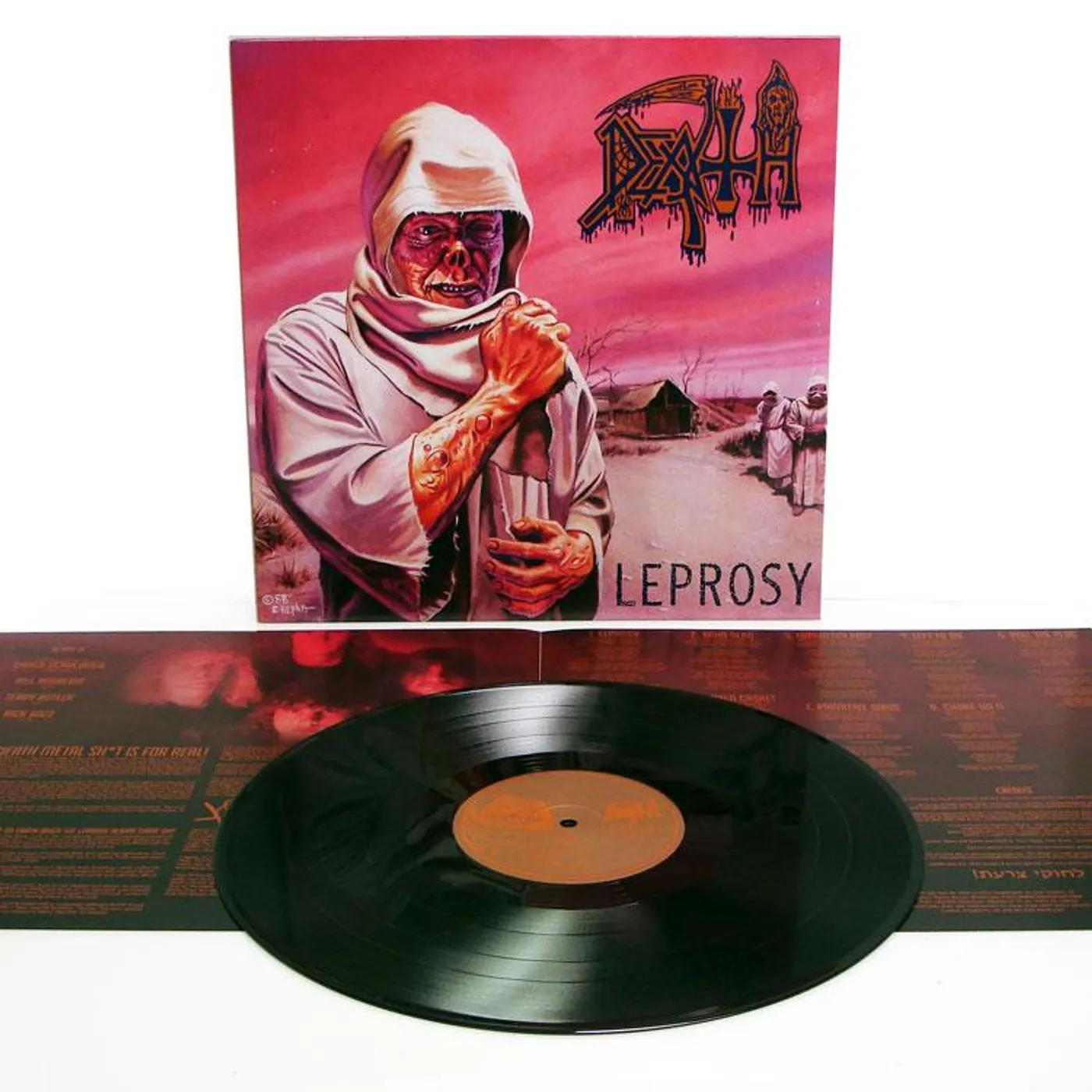 Leprosy