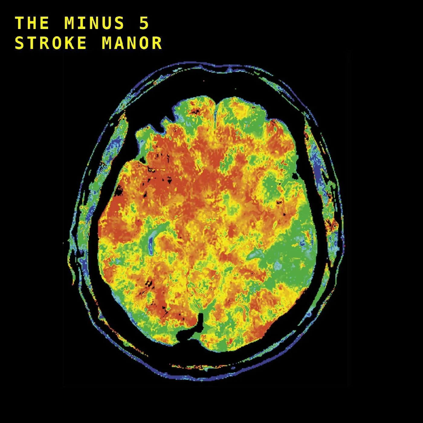 Minus 5 STROKE MANOR CD