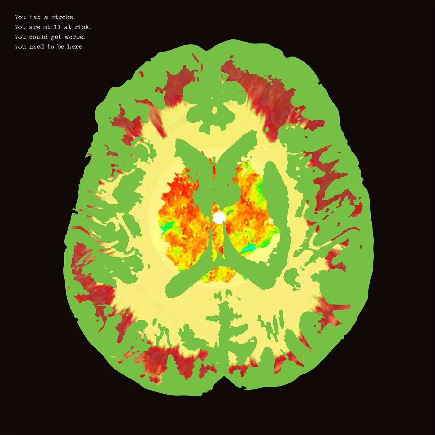 Minus 5 Stroke Manor Vinyl Record