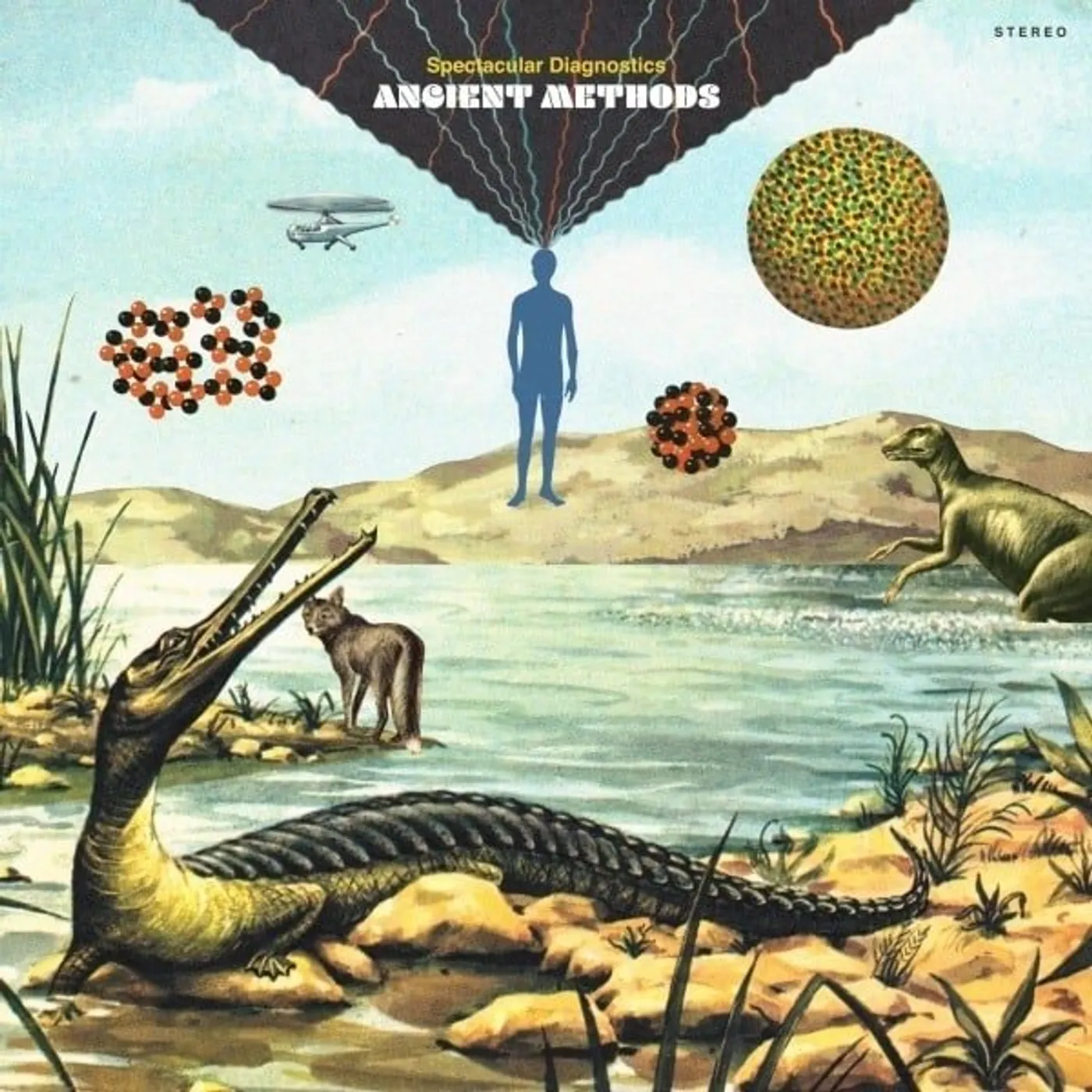 Spectacular Diagnostics Ancient Methods Vinyl Record