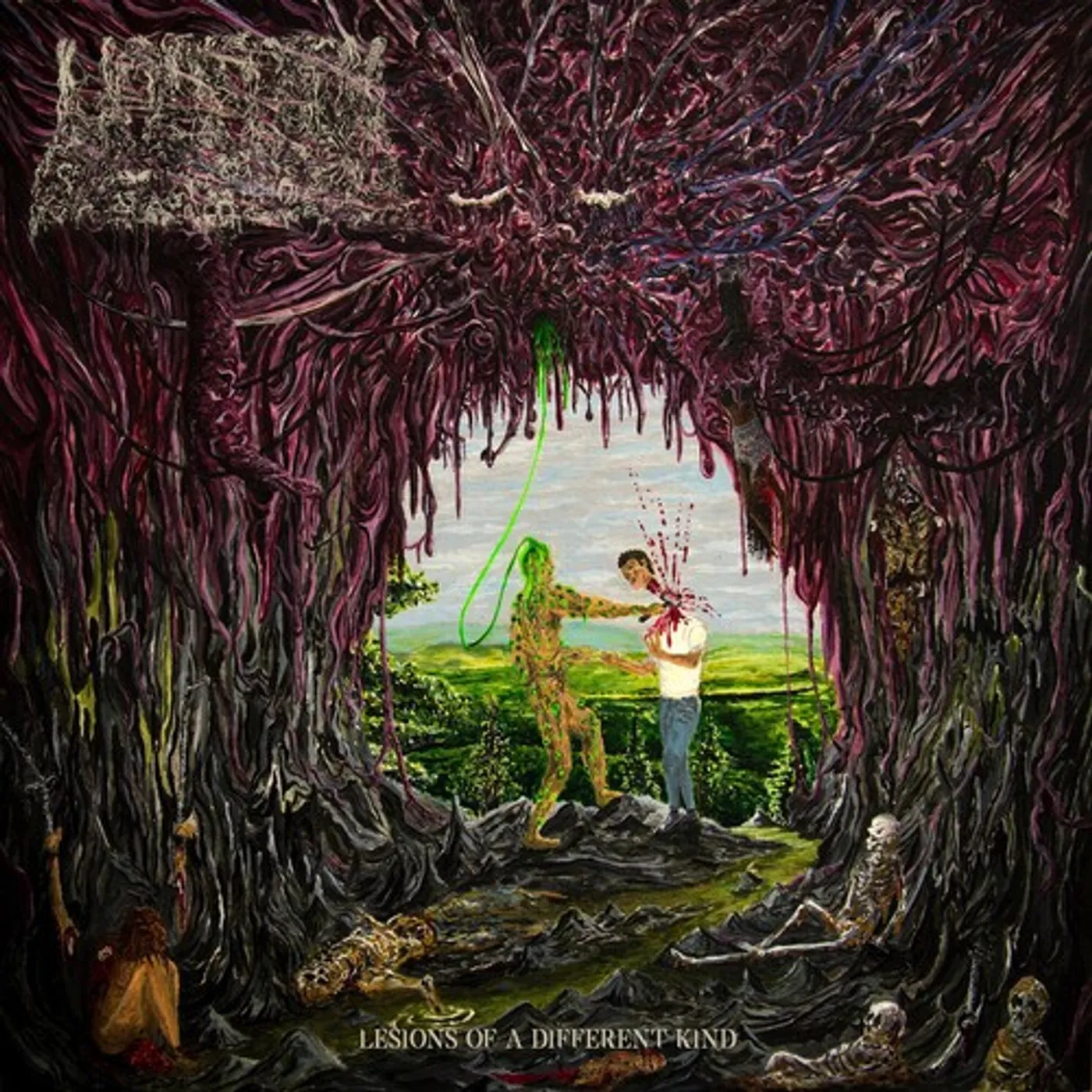 Undeath LESIONS OF A DIFFERENT KIND CD
