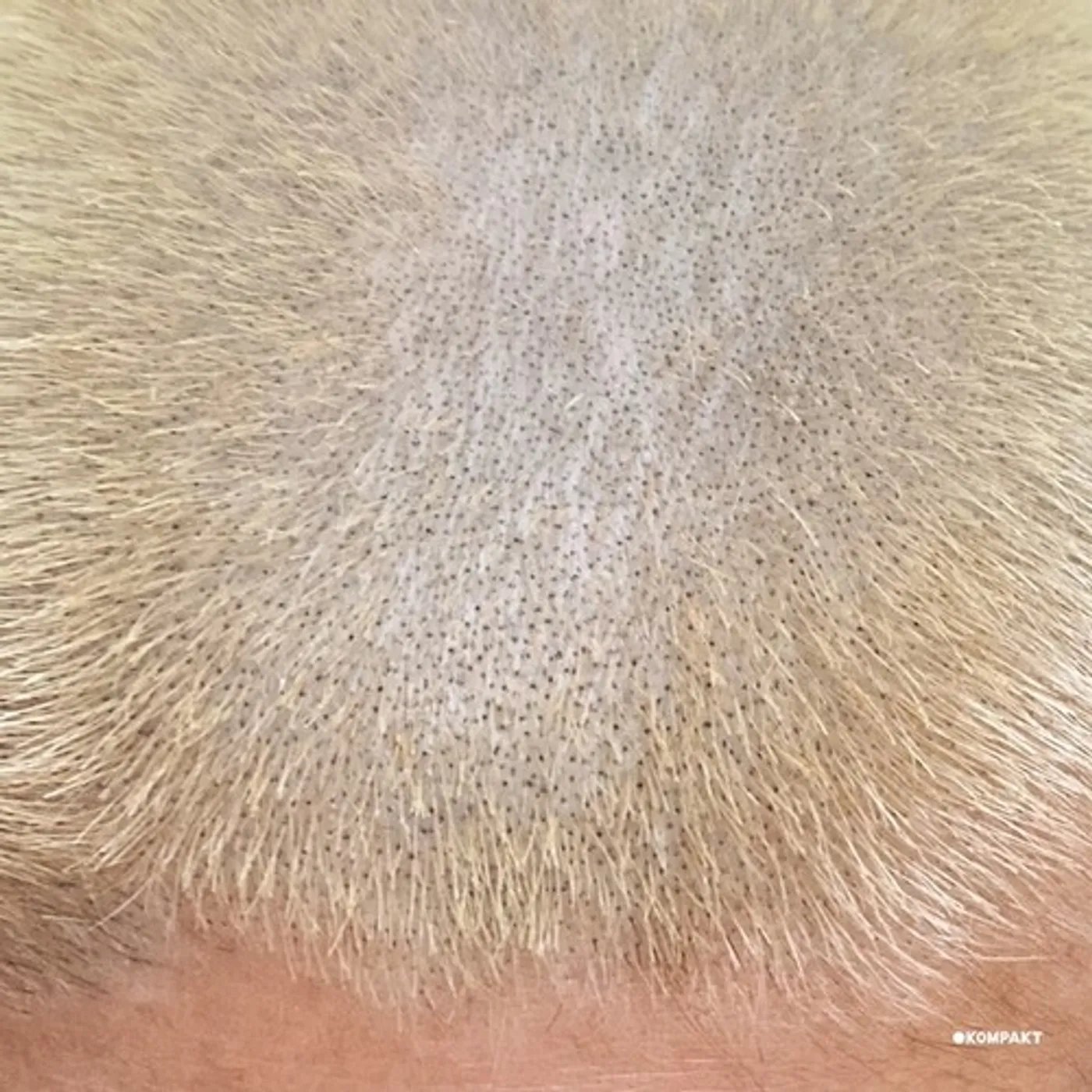 Barnt ProMetal Fan Decor Only Product Vinyl Record