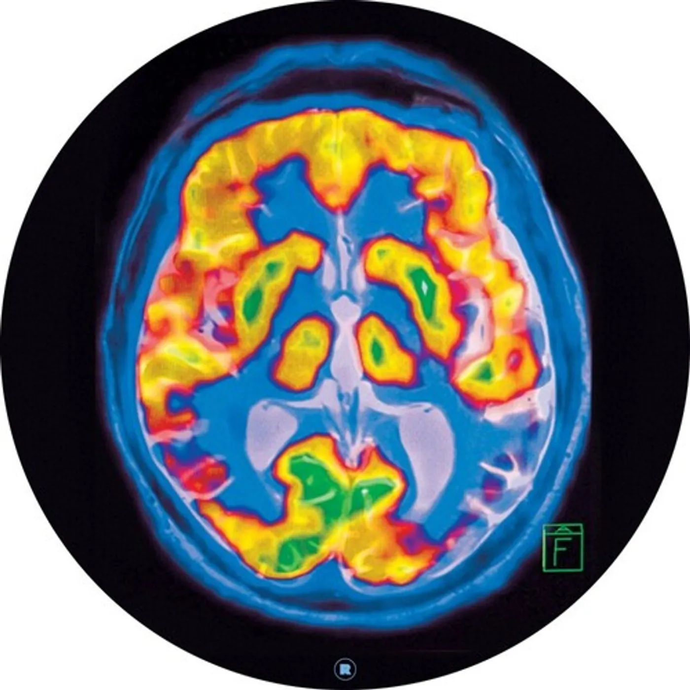 Frankey & Sandrino Brainscan Vinyl Record