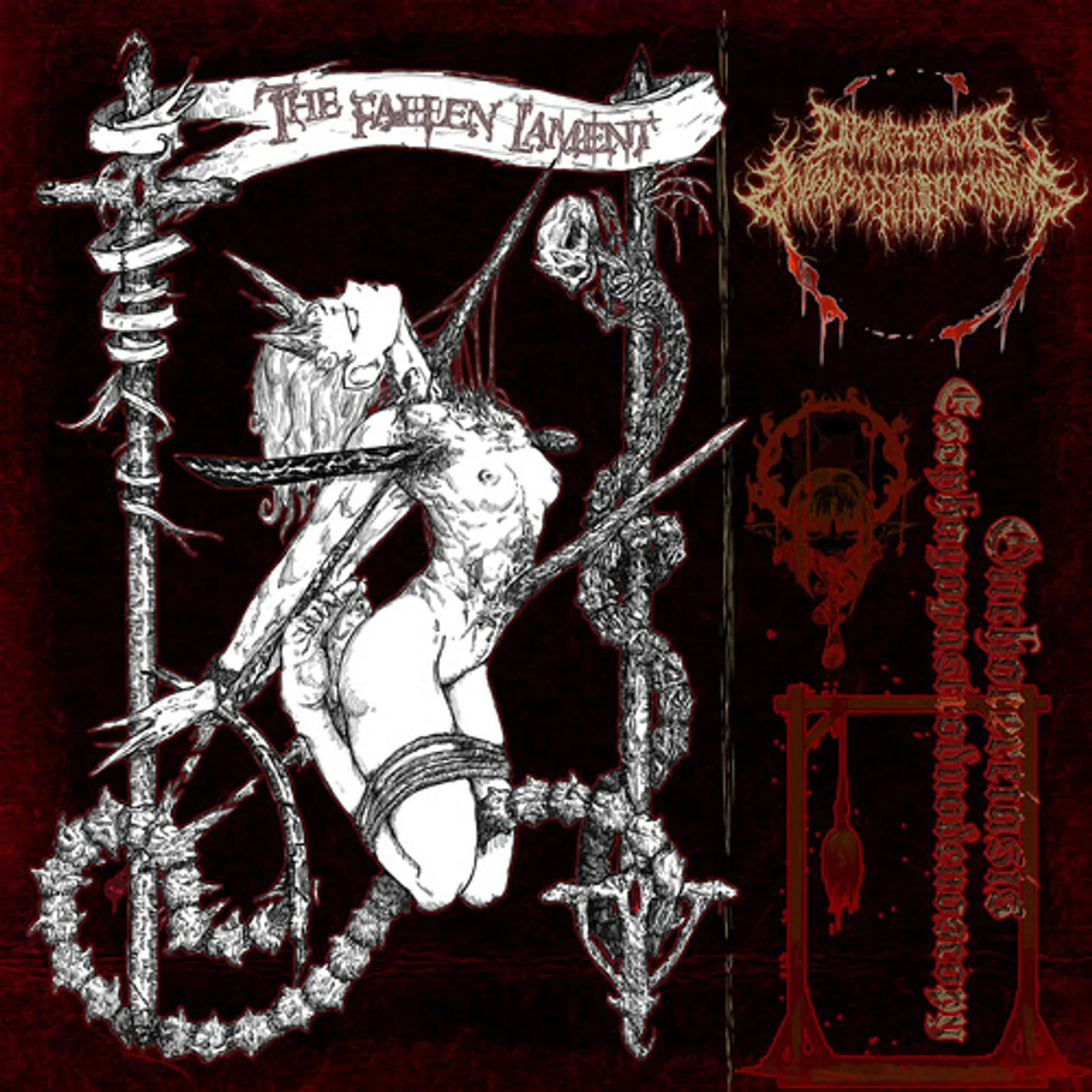 Onchocerciasis Esophagogastroduodenoscopy FALLEN LAMENT CD