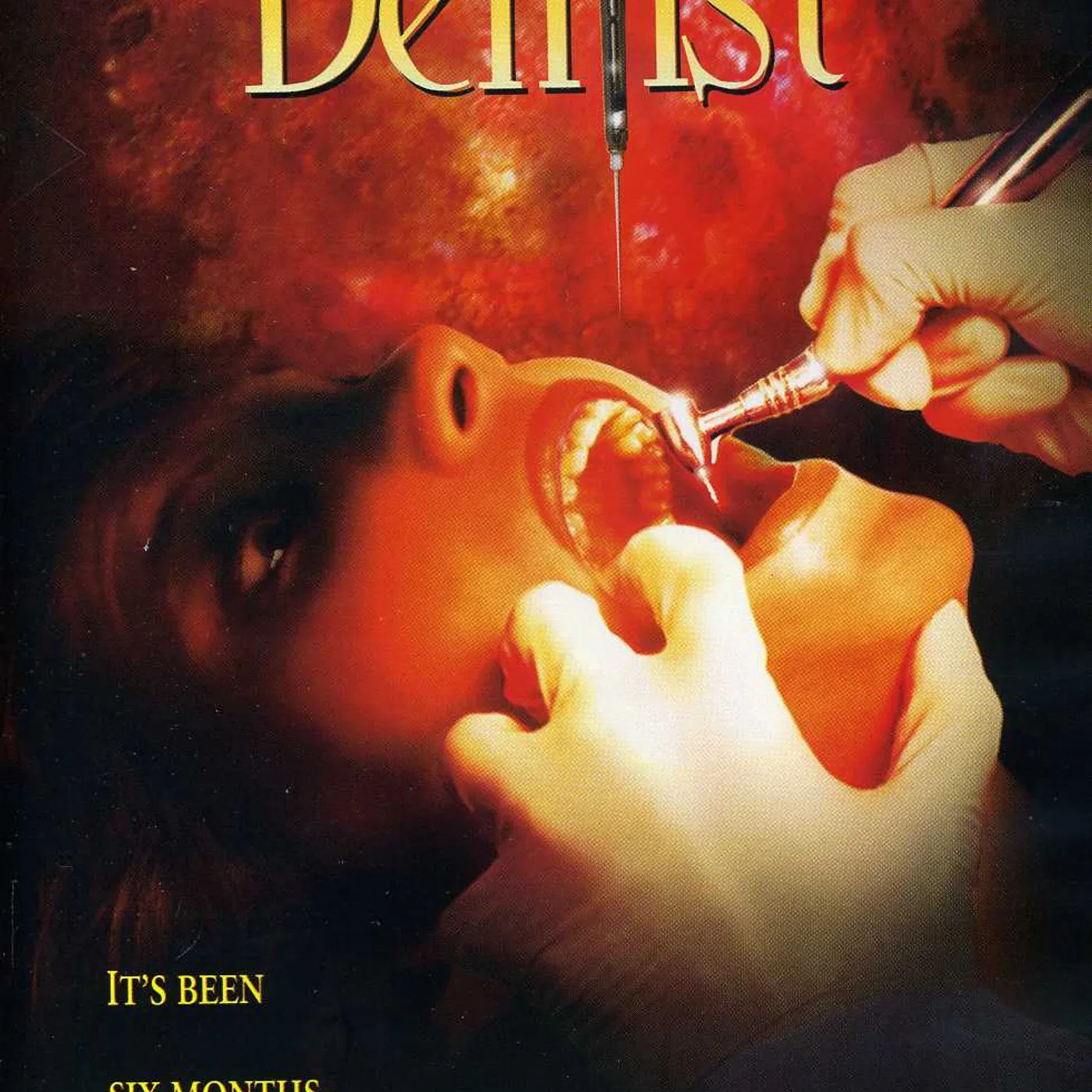 Dentist (1996) DVD