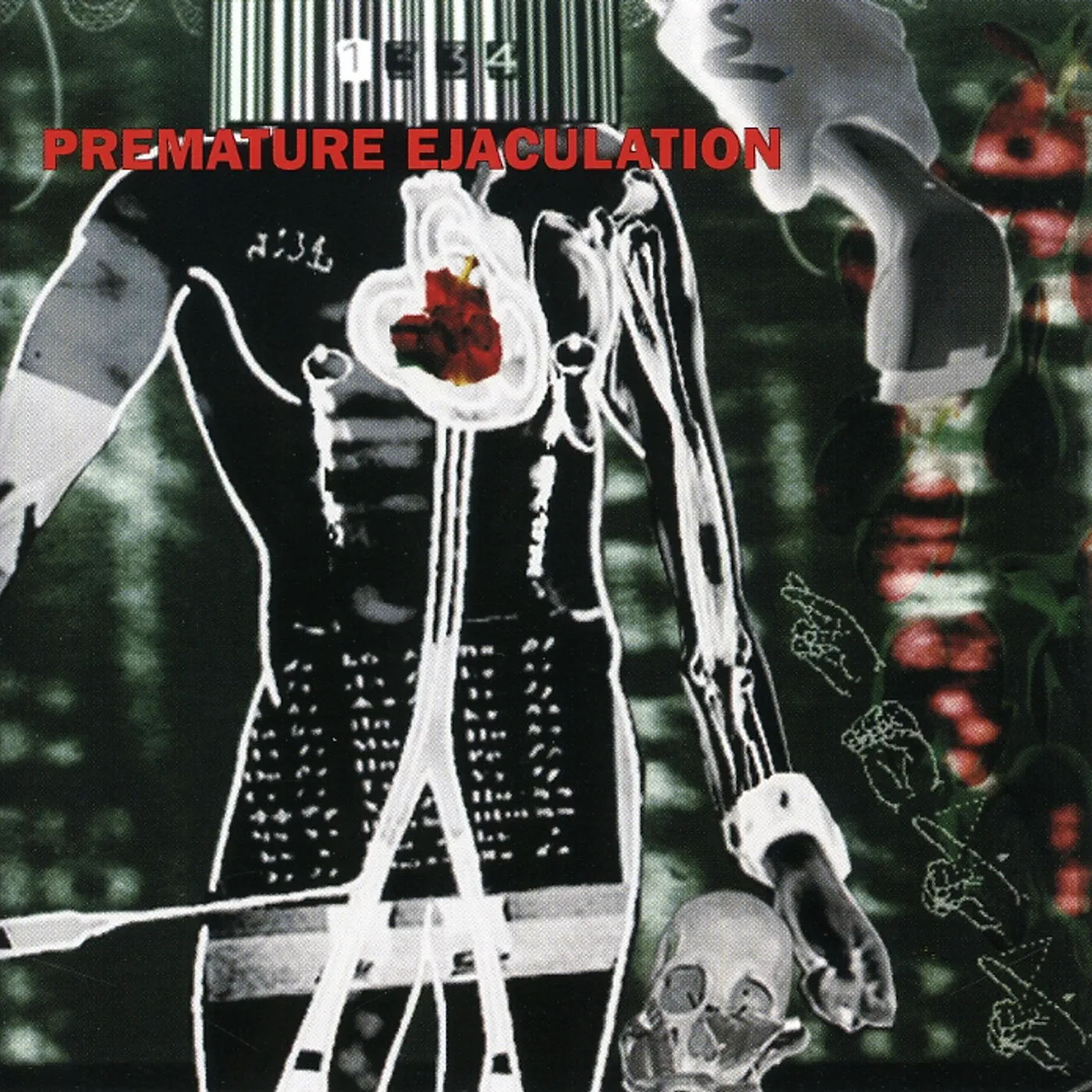 Premature Ejaculation ASSERTIVE DISCIPLINE CD