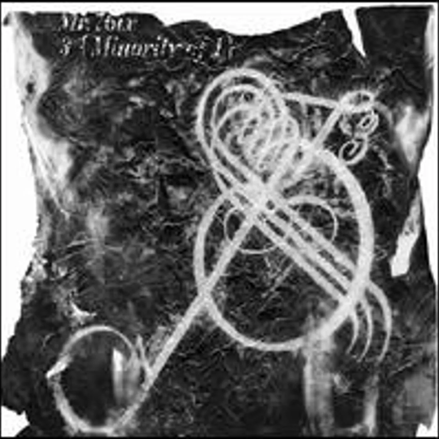 Mr 76ix 3 (MINORITY OF 1) Vinyl Record
