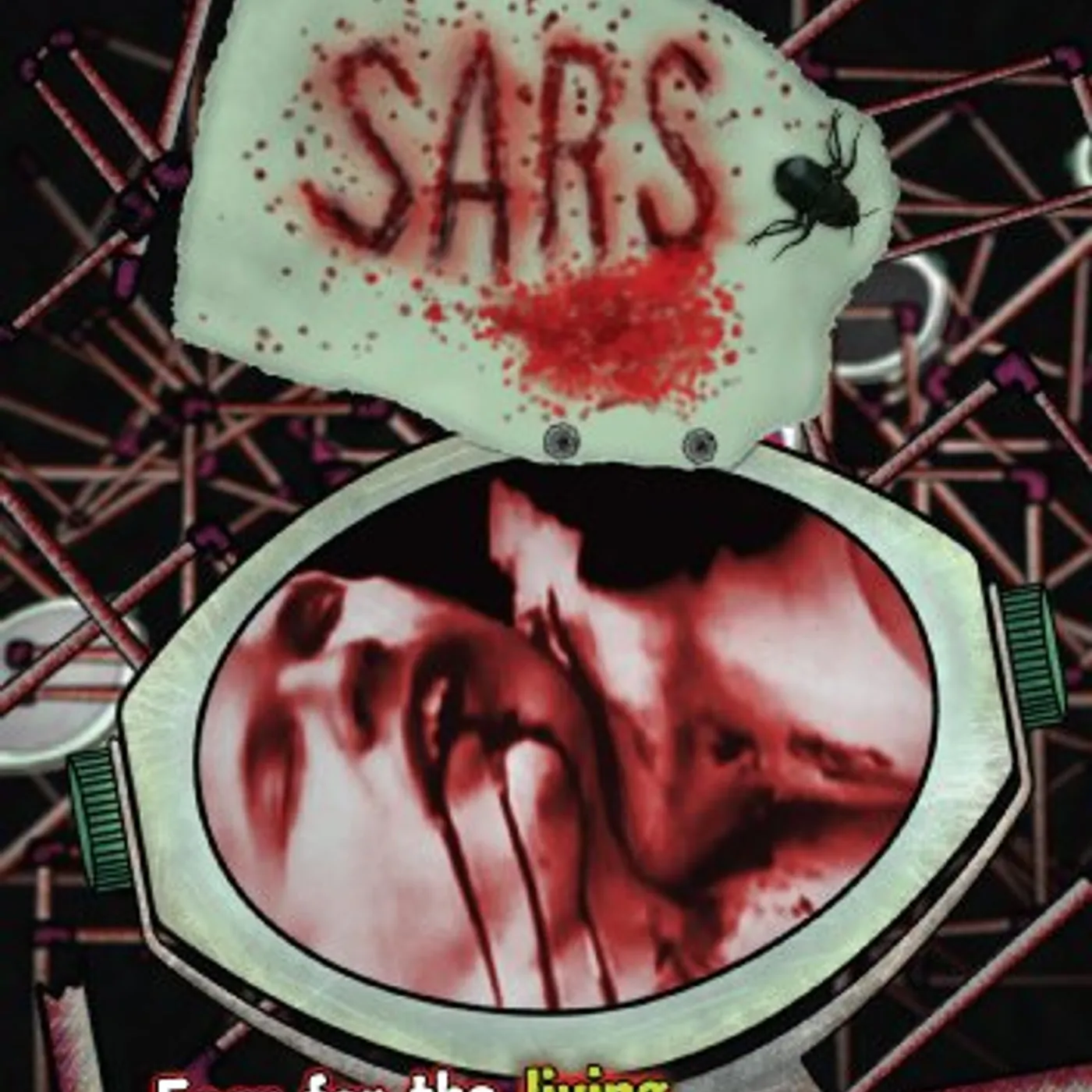 SARS DVD
